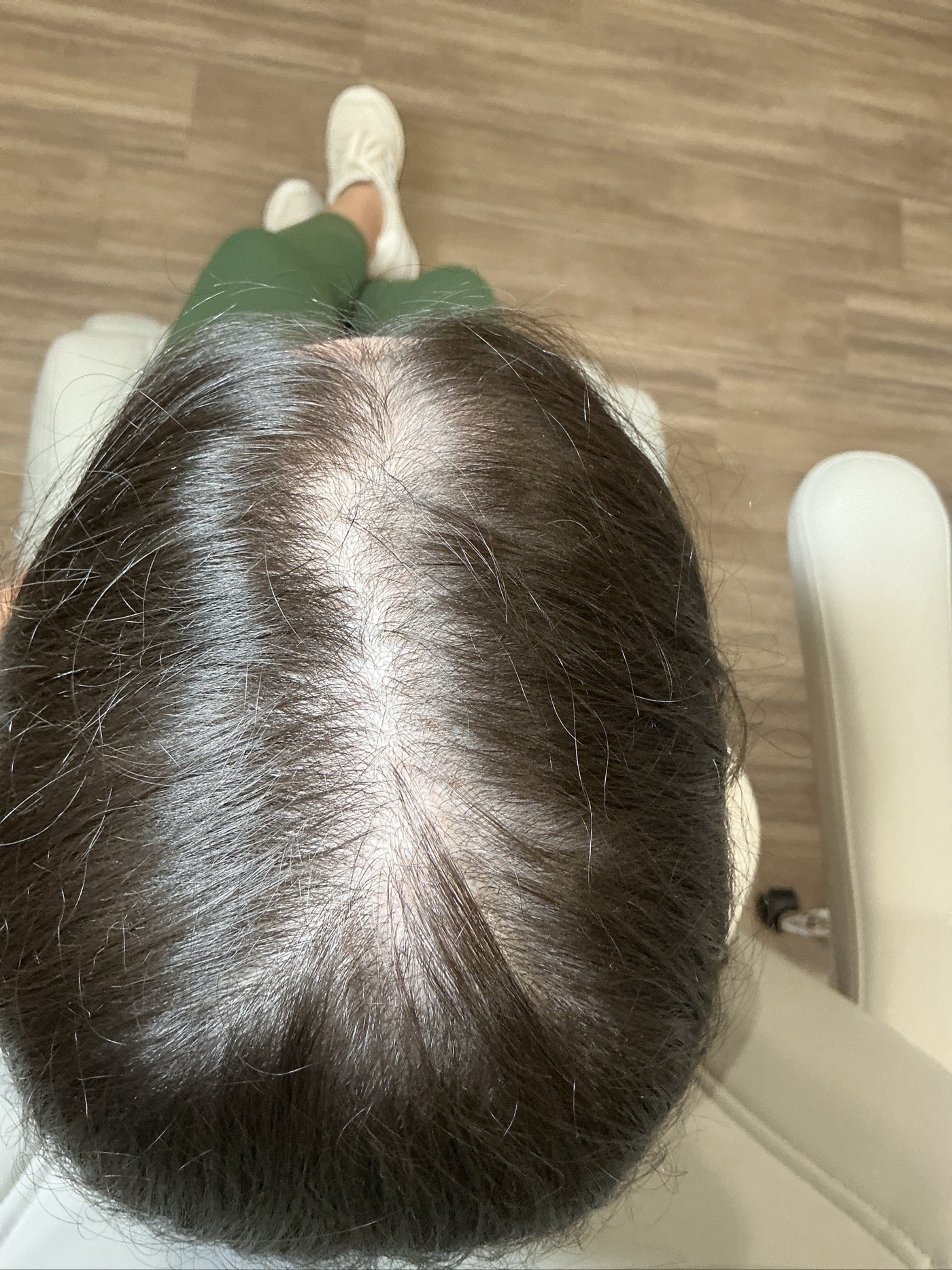 1st treatment - Apr. 2, 2025