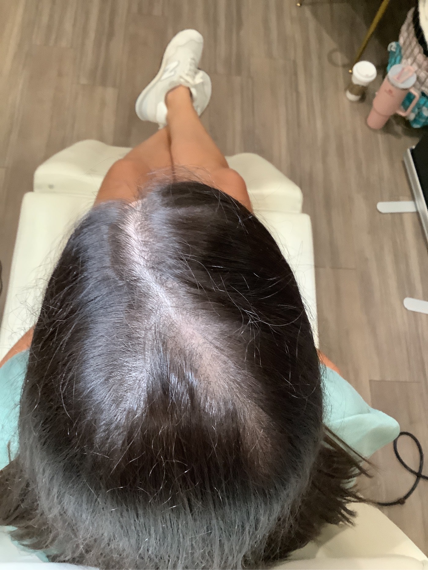3rd treatment - June 25, 2025