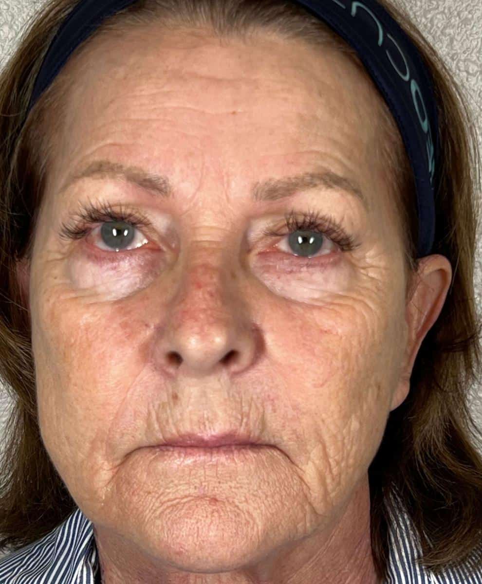 a close up of a man wearing glasses and smiling at the camera