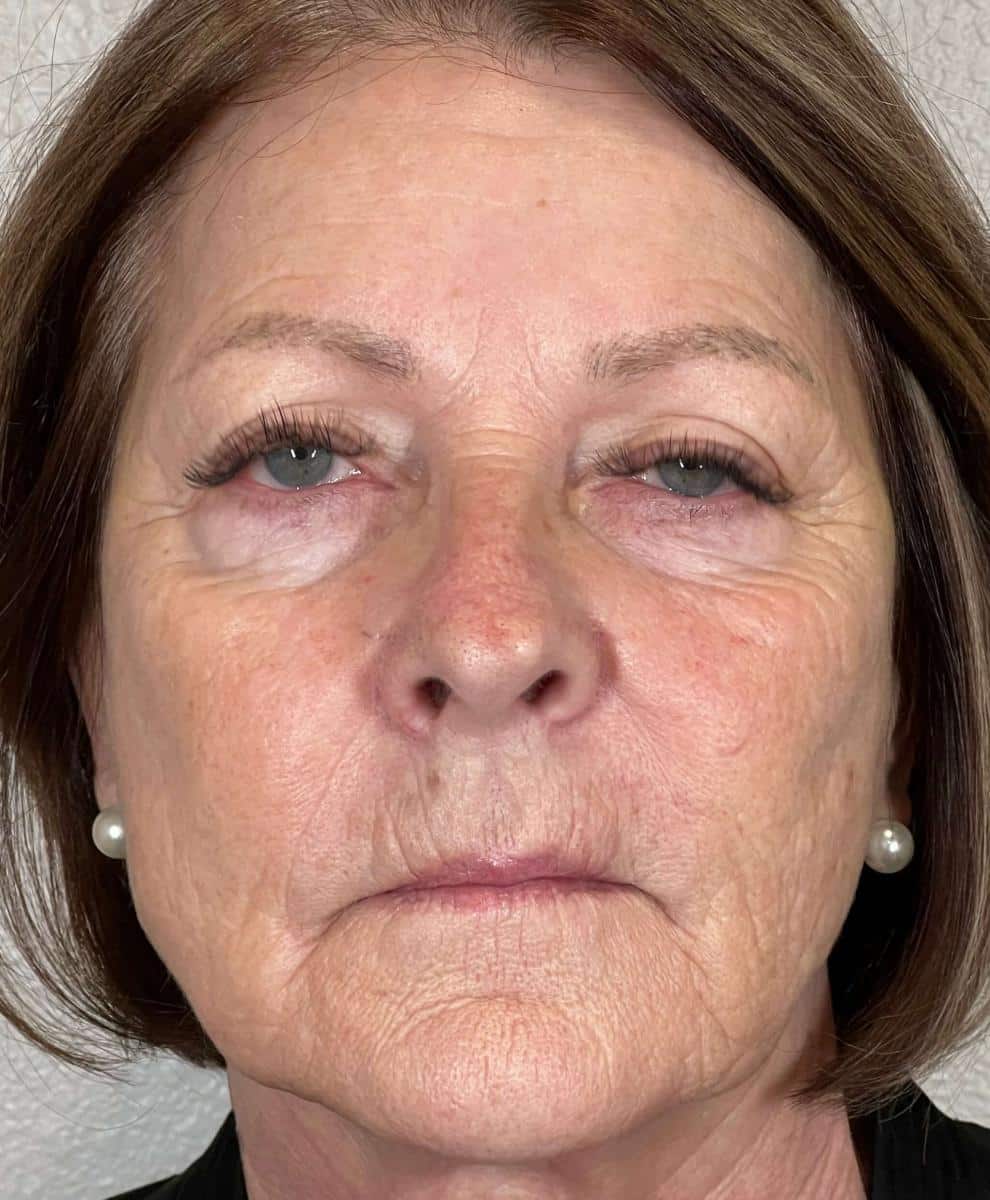 a close up of a person wearing glasses and smiling at the camera