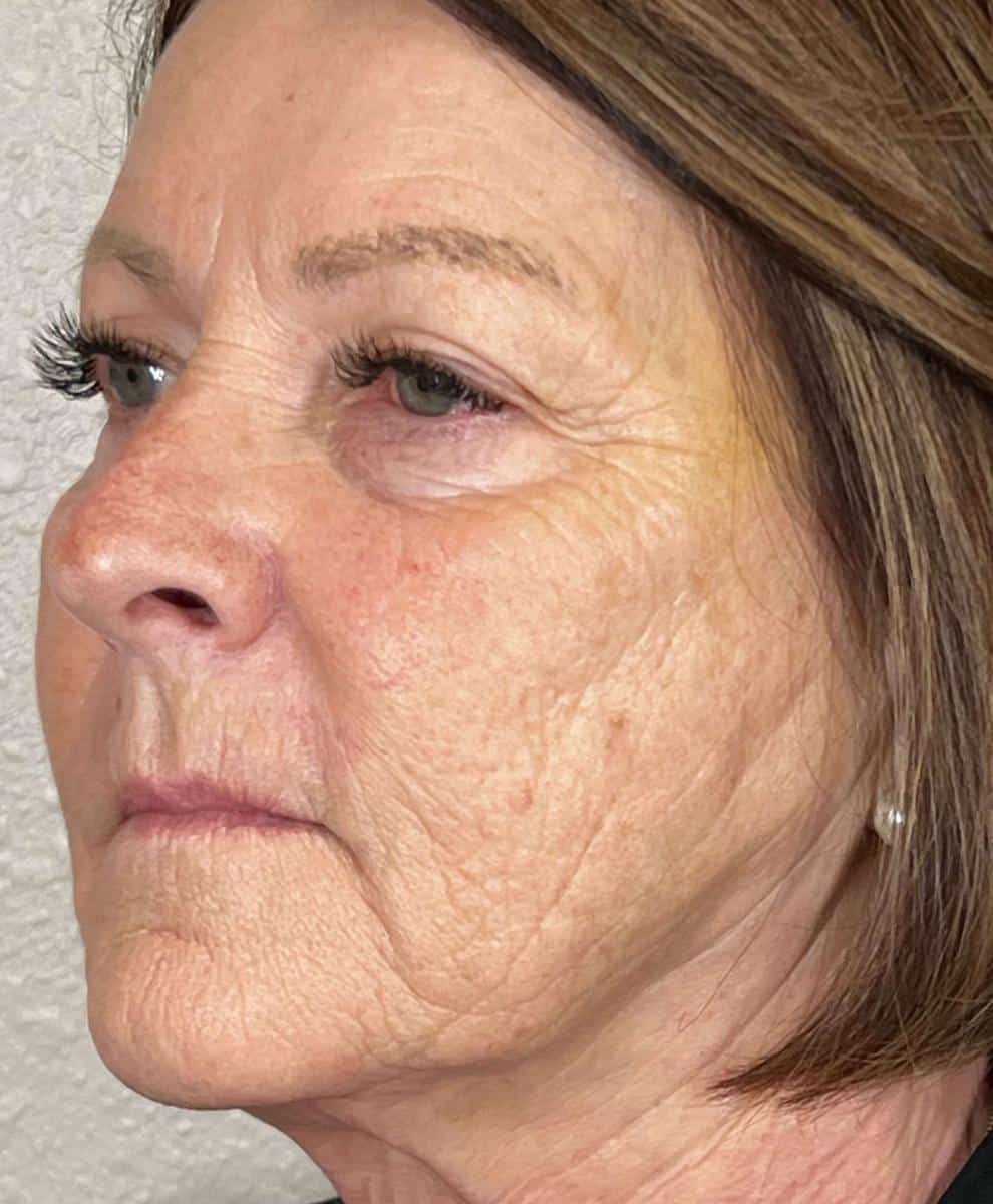 a close up of a person