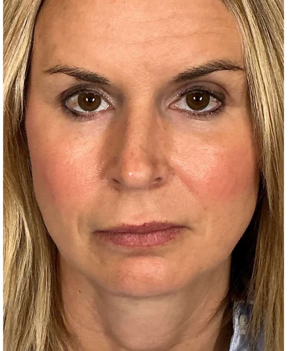 a close up of a person