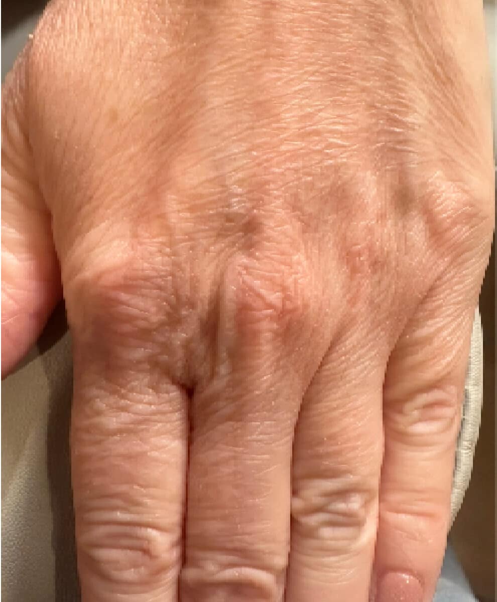 a close up of a hand